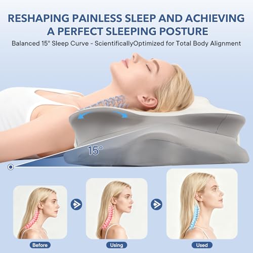 Cervical Pillow for Neck and Shoulder,Contour Memory Foam Pillow,Ergonomic Neck Support Pillow for Side Stomach Back Sleepers with Skin-Friendly Pillowcase (White) - color: White