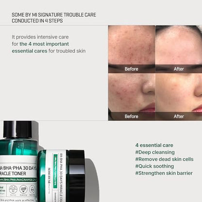 SOME BY MI AHA BHA PHA 30Days Starter Kit - Toner 1.01Oz, Serum 0.33Oz, Cream 0.7Oz, Cleansing Bar 1.05Oz - Mild Exfoliating Daily Skin Care Set - Skin Wastes, Sebum, Oiliness Care - Korean Skin Care - color: Miracle Kit with Bar