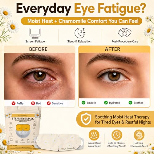 Eye Serenity Steam Eye Mask, Heated Eye Mask, Self Heating Warm Compress for Dry Eyes, Fast Relief for Stye, Puffy Sensitive Eyes, Moist Heat, Relaxation Gifts for Women and Men - Chamomile - color: Chamomile 15 Pack, size: 15 Eye Masks