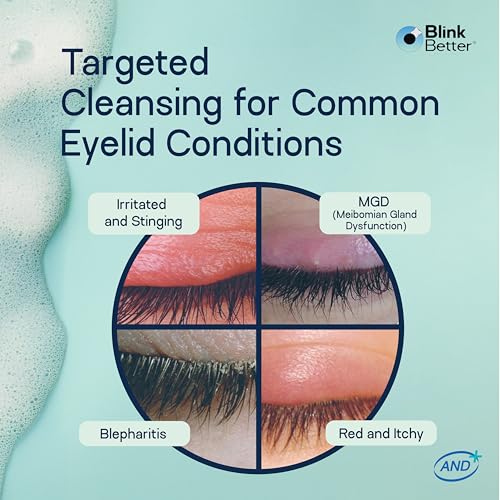 BlinkBetter BetterLids Foaming Eyelid Cleanser – Gentle Daily Foam for Eyelids & Lashes – Soothing Tea Tree Oil Formula with Ectoin & Centella, Non-Stinging, Preservative-Free, 2 fl oz