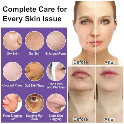 Skin Care Set,6Pcs Professional Womens Teens Tighten Lift Firm Skincare,Hydrate Anti-Aging Facial Routine Kit Travel Gift Set,Birthday Christmas Secret Santa Gifts for Women Teenage Girl Wife Mom | Professional
